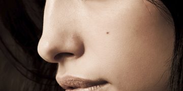 Non Surgical Rhinoplasty